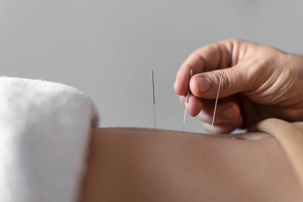 close-up hand holding acupuncture needle