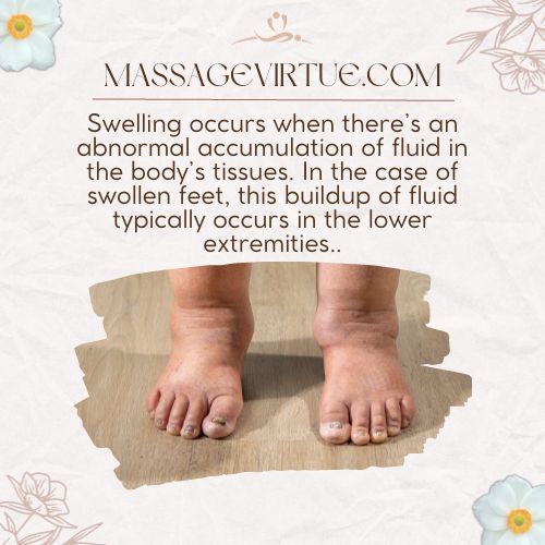 Swelling, medically known as edema, occurs when there's an abnormal accumulation of fluid in the body's tissues.