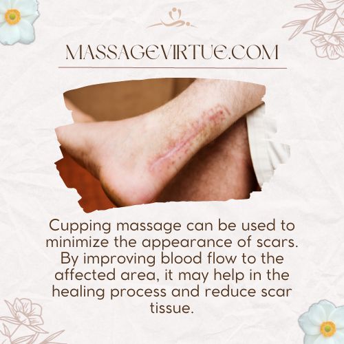 Cupping massage can be used to minimize the appearance of scars.